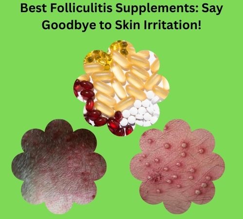 Best Folliculitis Supplements