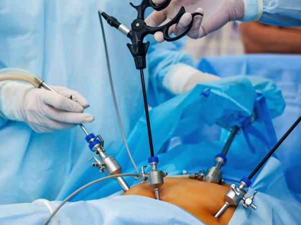 Laparoscopic surgery in Dubai