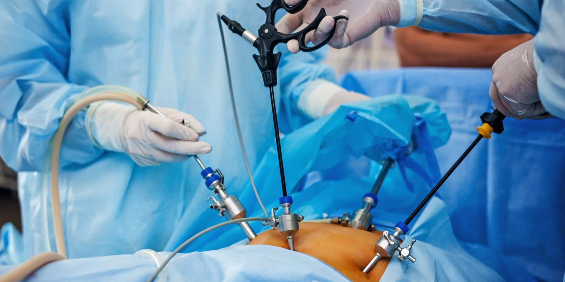 Laparoscopic surgery in Dubai